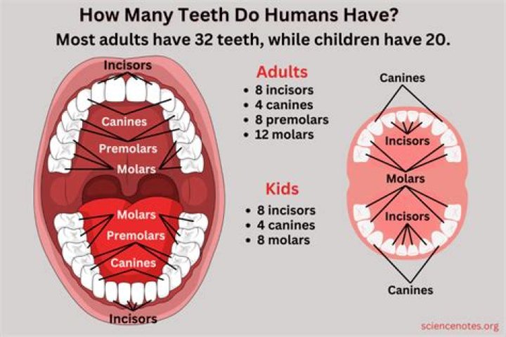 At what age all 32 teeth comes?