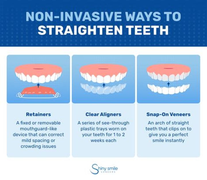 Can teeth naturally straighten?
