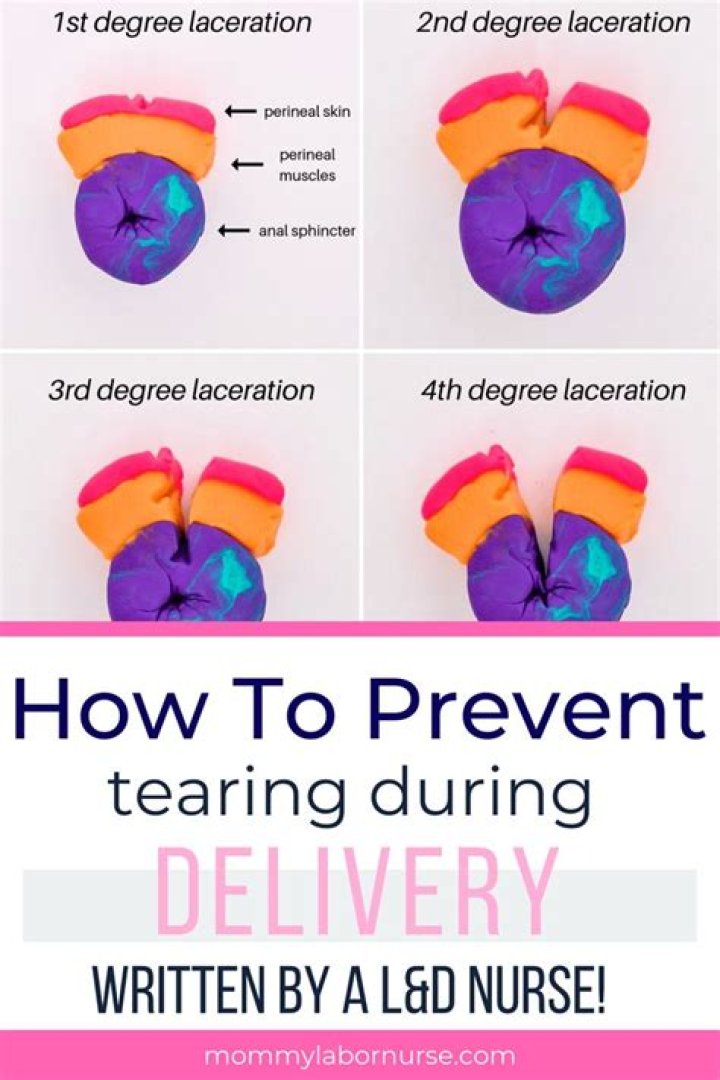 How can I prevent tearing during delivery?