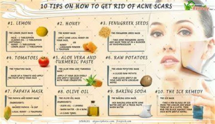 How do you get rid of dark acne scars?