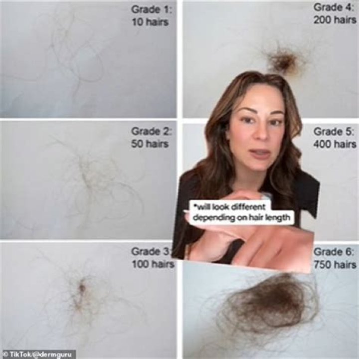 Is hair on your head dead?
