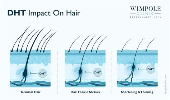 What causes dead hair follicles?