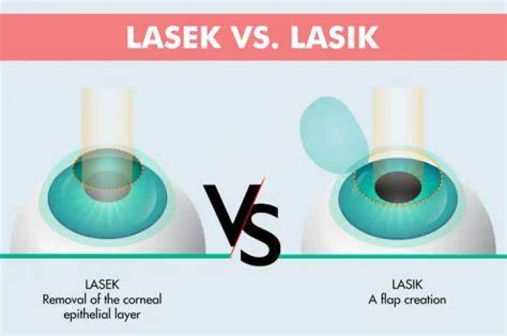 What is difference between LASIK and Lasek?