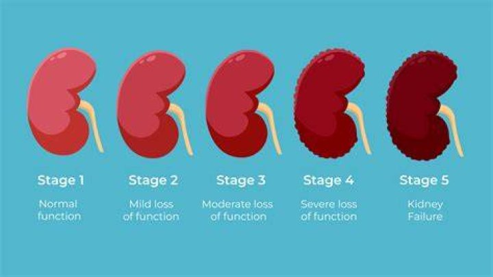What is the life expectancy of someone with kidney failure?
