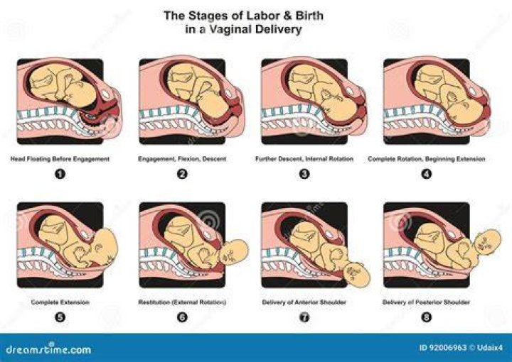 Which stage of delivery is the least painful?