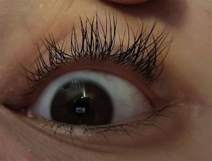 Why do I have 3 rows of eyelashes?